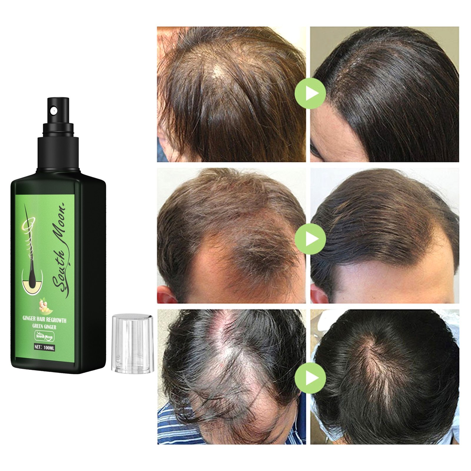 100ml-Hair-Growth-Serum-Hair-Lotion-Anti-Hair-Loss-Herbal-HairReBirth-Essence-Spra-Y-Serum-Ginger (4)